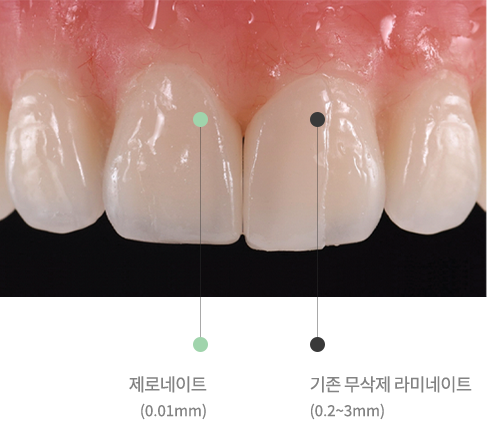 제로네이트(0.01mm), 기존 무삭제 라미네이트(0.2~3mm)